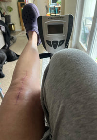 ACL & MCL Surgery · 10 months post-op
